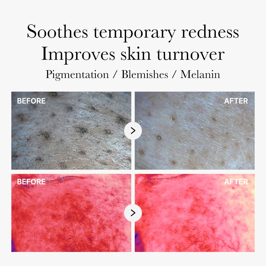 Medicube Red Succinic Acid Peeling Pad 155G/70Pads