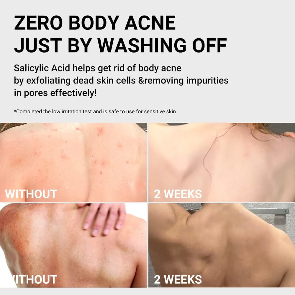 Medicube Red Acne Body Wash 400G